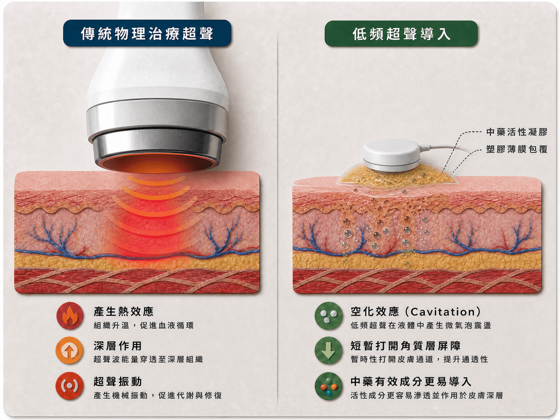 低頻超聲導入技術示意圖：空化效應暫時提高皮膚通透性